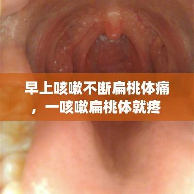 早上咳嗽不断扁桃体痛,一咳嗽扁桃体就疼