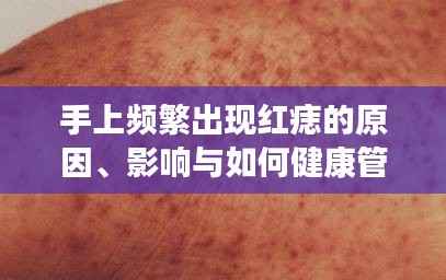 手上频繁出现红痣的原因、影响与如何健康管理关注必看!
