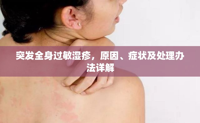 突发全身过敏湿疹,原因、症状及处理办法详解